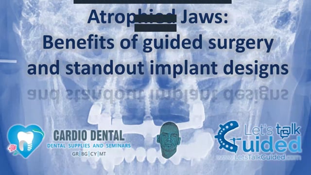 Advanced guided implantology: Loading of compromised cases & benefits of stackable guides.