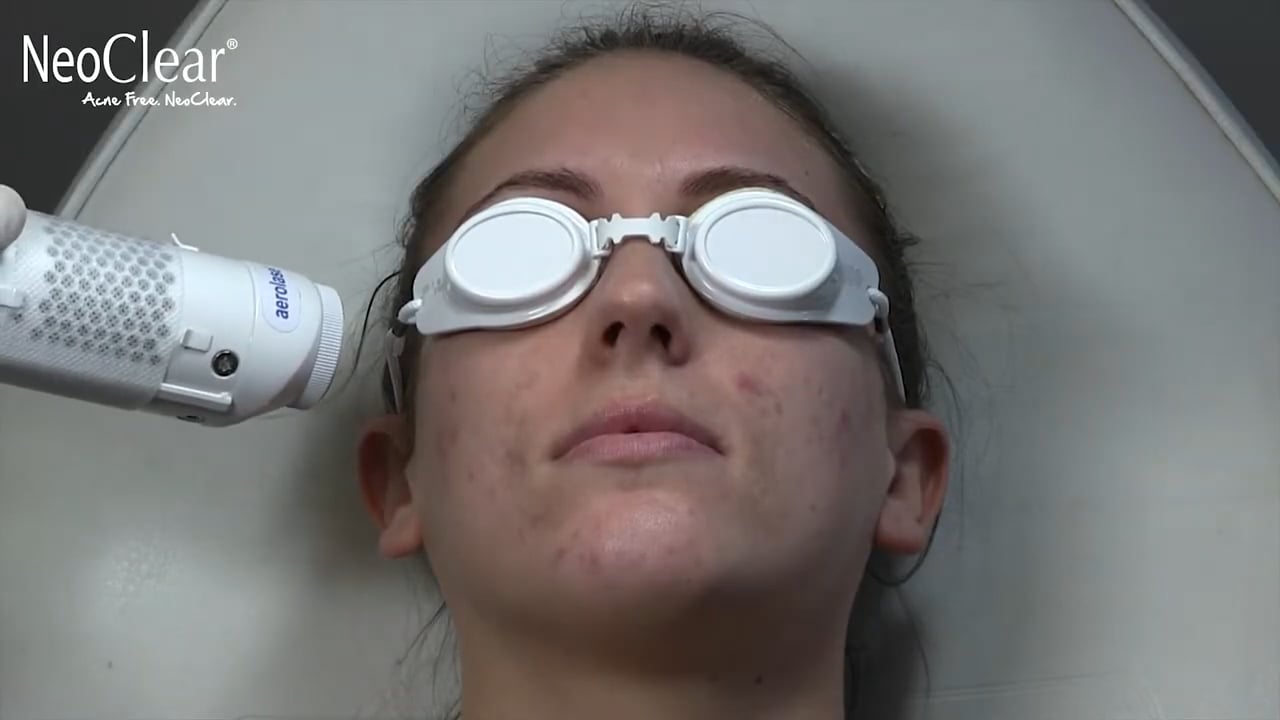 Emily's NeoClear Story on Vimeo