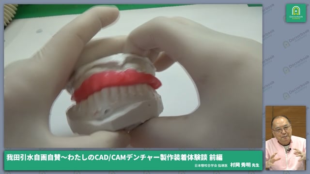 ホースシュータイプ義歯と即時義歯の製作