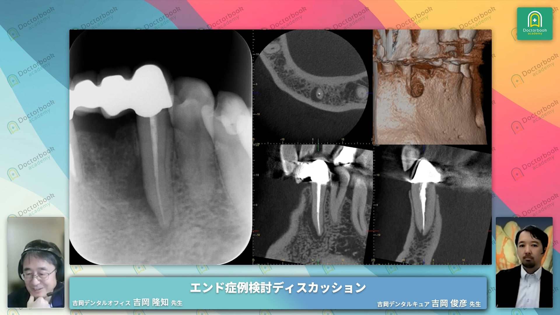 「1回治療VS複数回治療」日本と海外の治療方法や考え方の違い