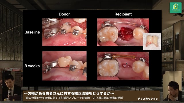 【動画まとめ買い特典映像】症例ディスカッション│聴講生からの疑問に答えて