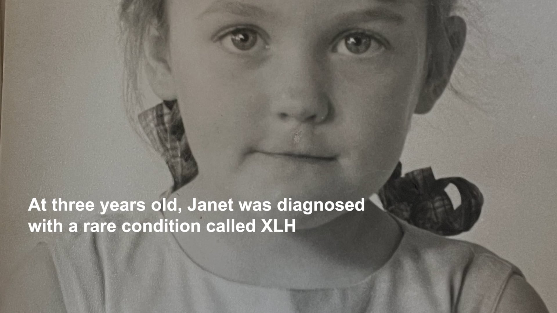 Janet & Luke | Living with XLH | XLHUK