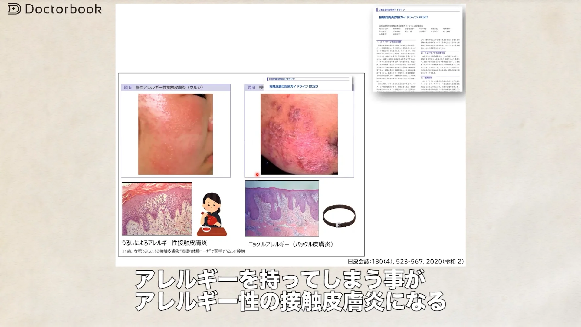 医師出演】接触皮膚炎の概要と原因物質 | Doctorbook