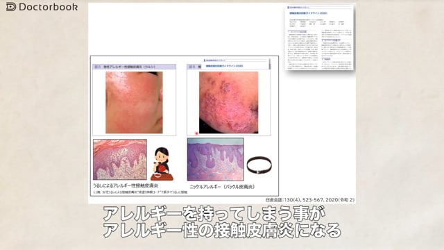 接触皮膚炎の概要と原因物質