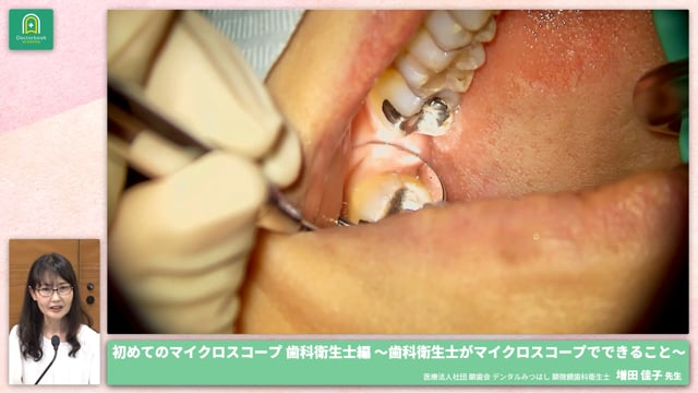 #1 歯科衛生士がマイクロスコープでできること