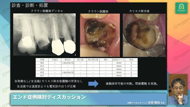 Endo Case Discussion NEXT - 若手ドクター×エンド専門医 症例 