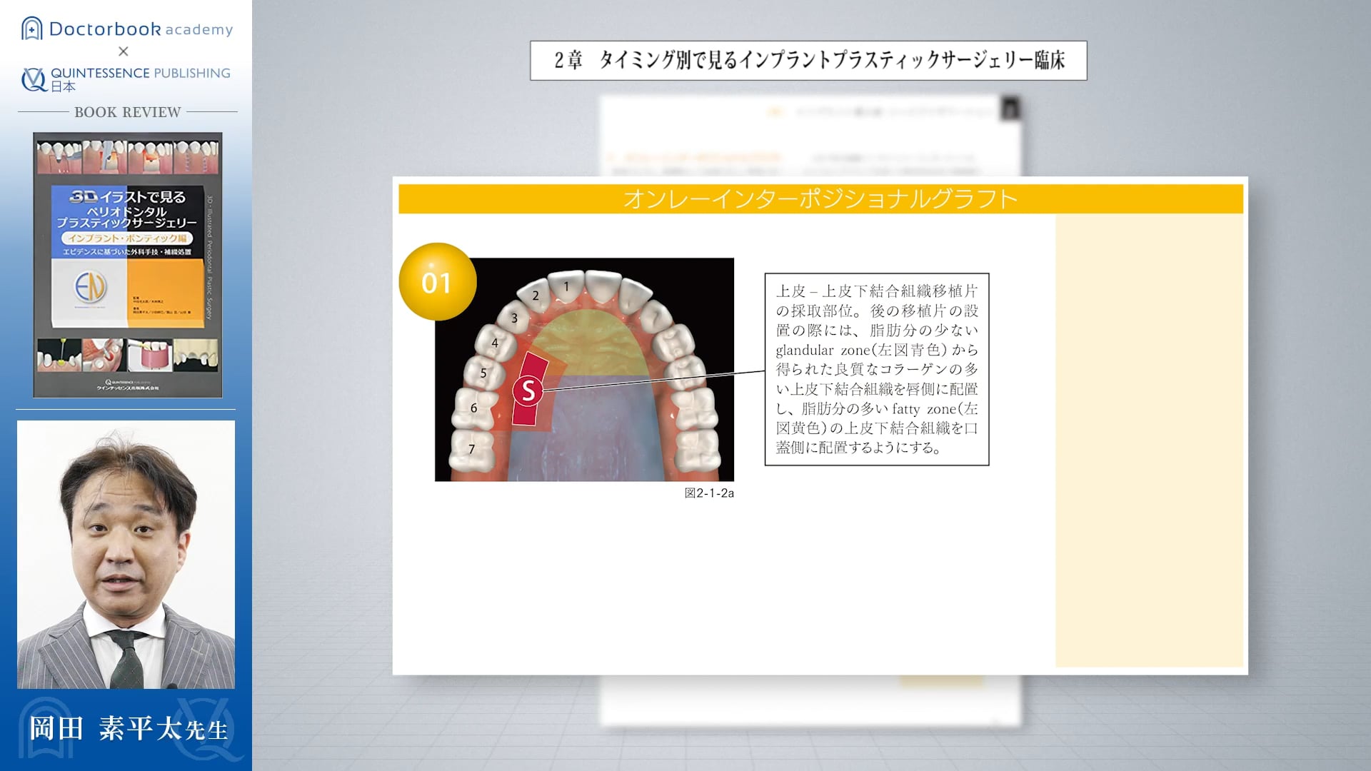 臨床知見録_プリザベーション_オンレーポジショナルグラフトについて