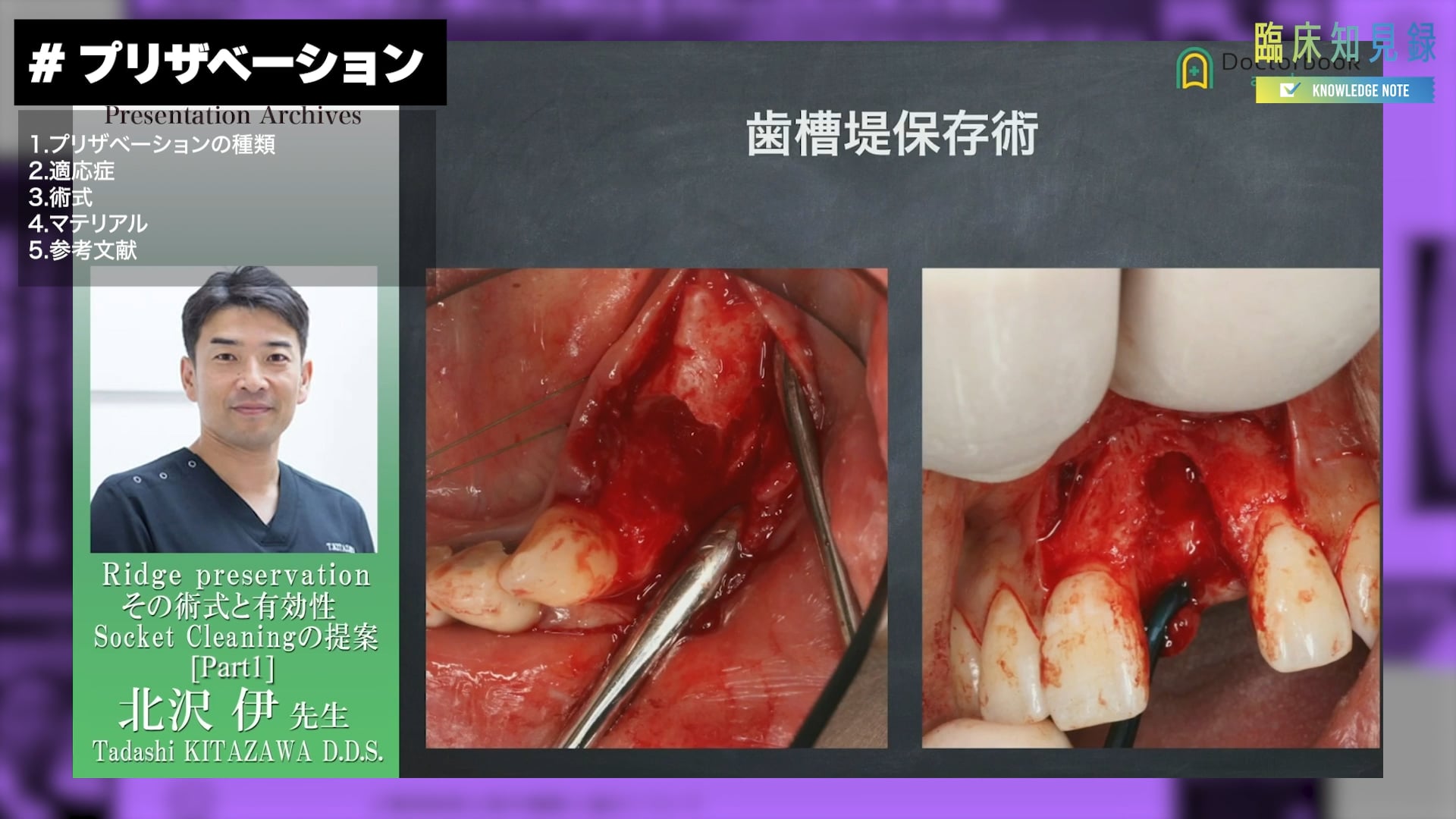 臨床知見録_プリザベーション_CM