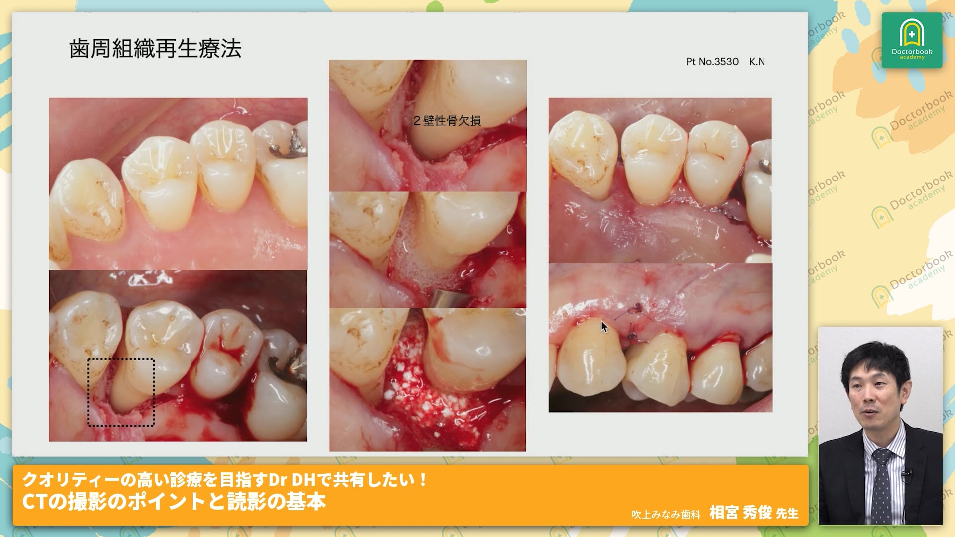 CTの撮影のポイントと読影の基本