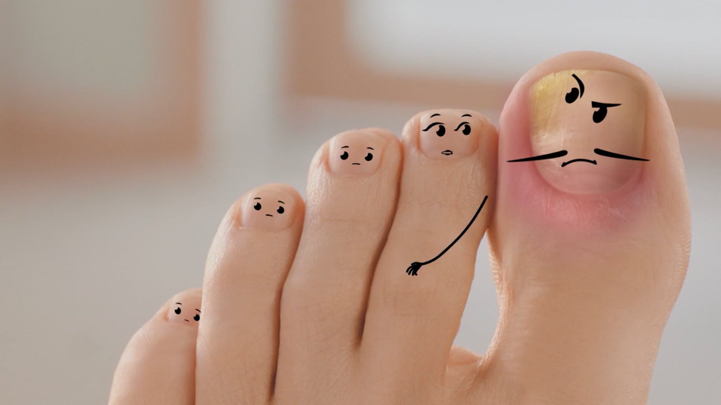 Mikoderil Jolly talking fingers man with talking male toes on his feet ...