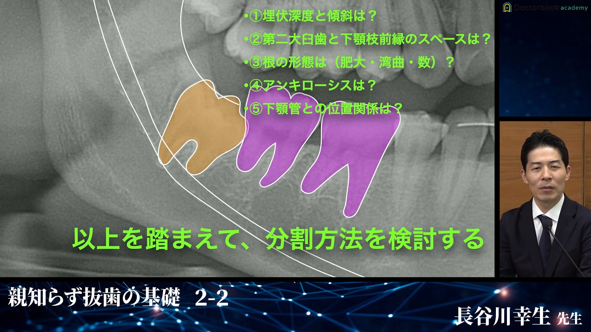 知っておくべき智歯の事前知識 解剖・麻酔・分類│完全版！埋伏抜歯のバイブル 2-2