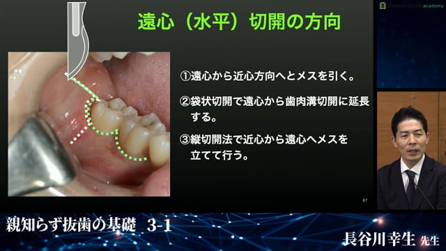歯肉切開・剥離の手技│完全版！埋伏抜歯のバイブル 3-1