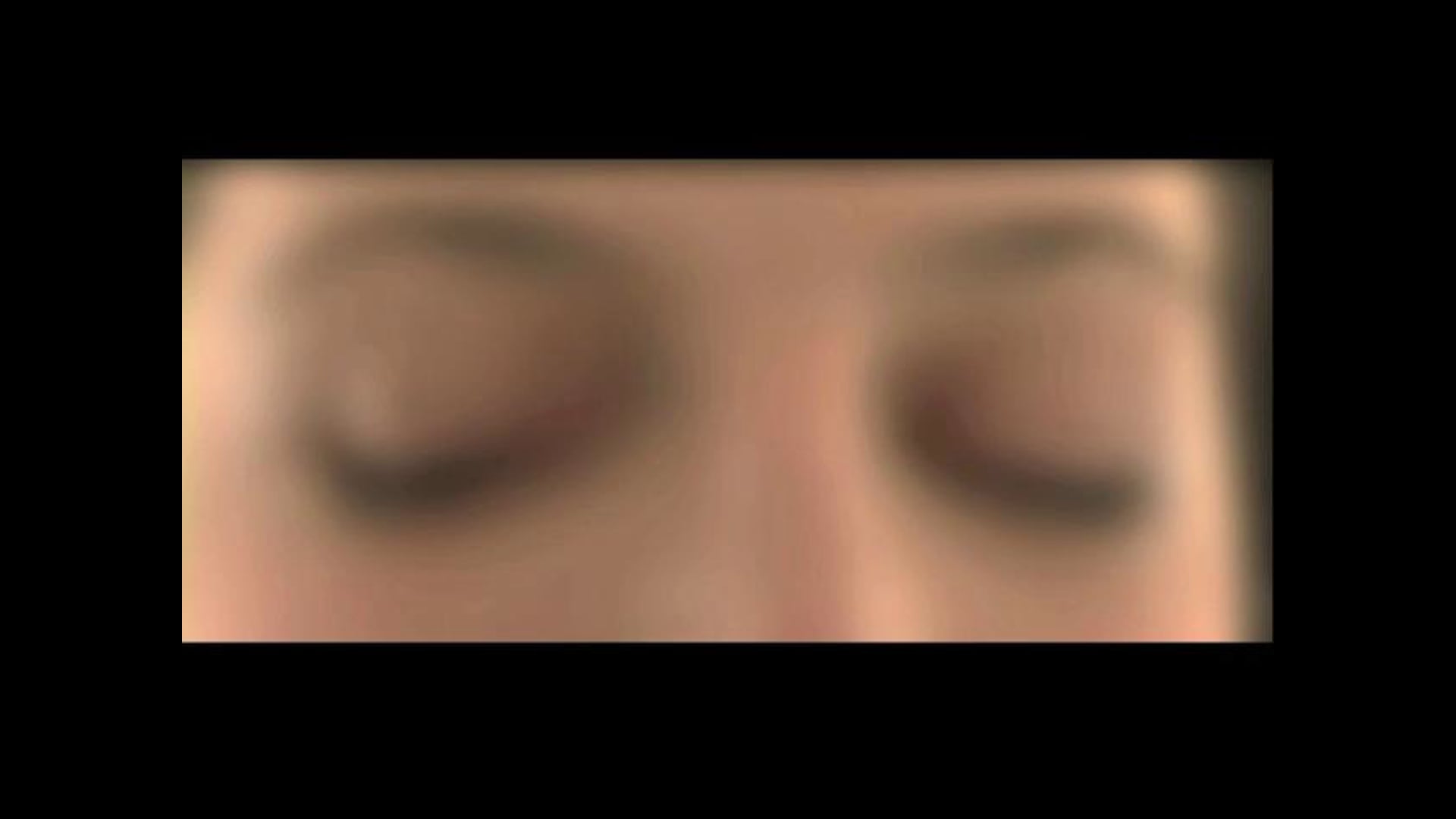 Des fourmis sous la peau