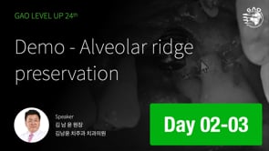 [LEVEL UP 24기 2회차] 03 DEMO - Alveolar ridge preservation - 김남윤 원장