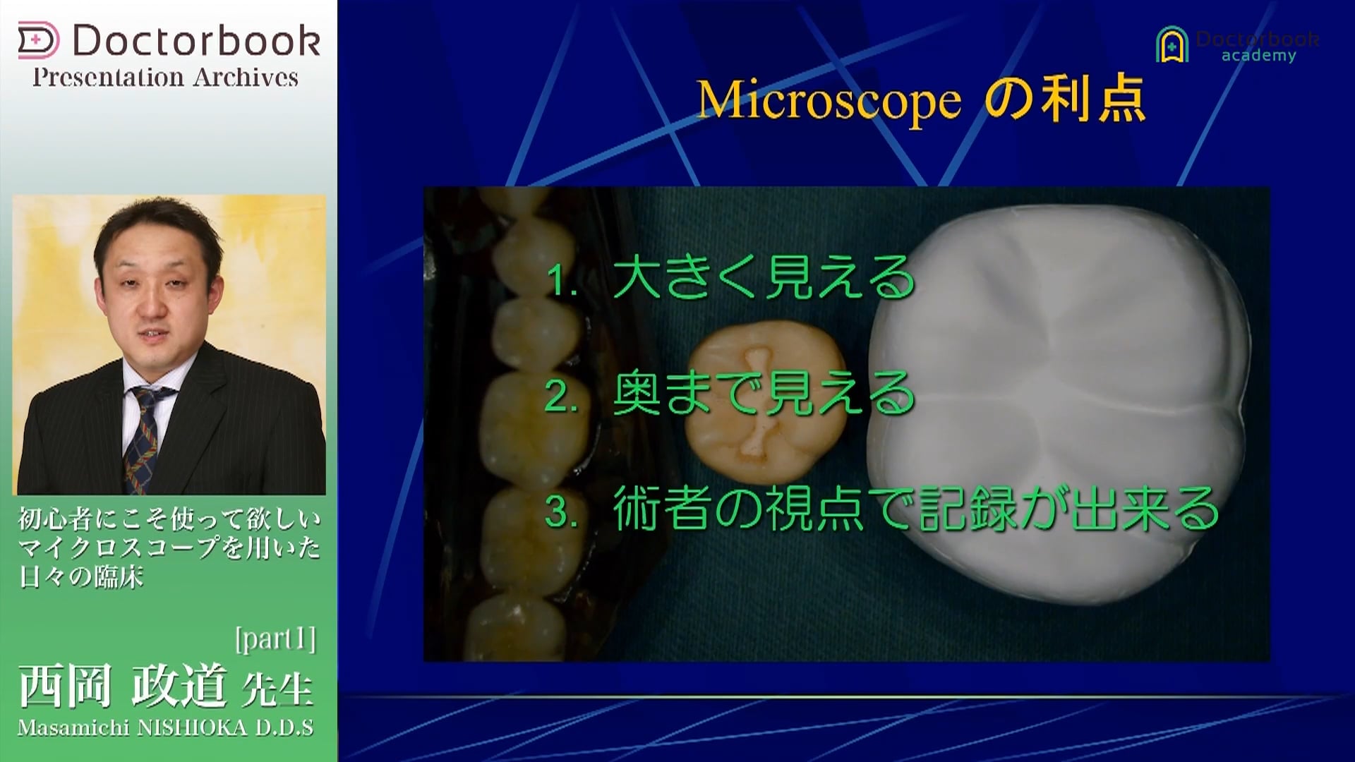 臨床知見録_初めてのマイクロスコープ_メリットとデメリットPart１