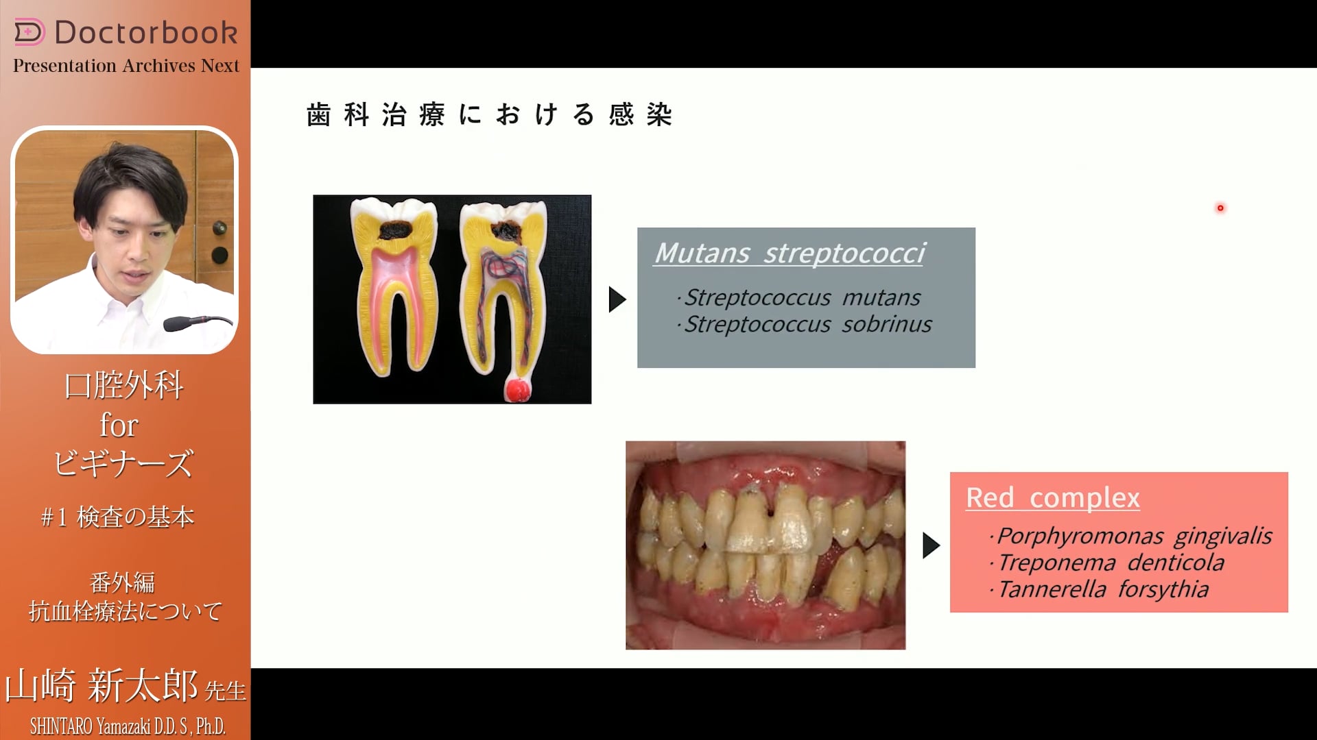 抗血栓療法/感染性心内膜炎について #5