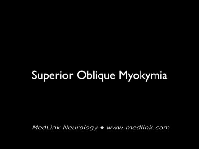 Superior oblique myokymia
