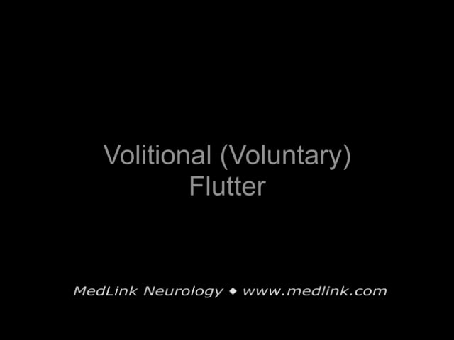 Nystagmus | MedLink Neurology