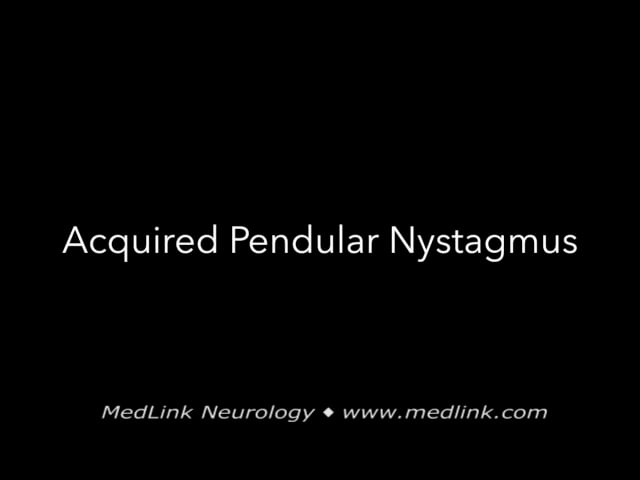 Acquired pendular nystagmus