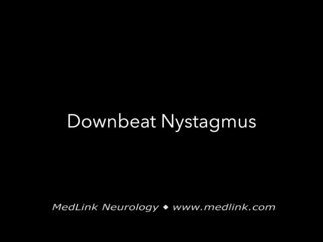 Downbeat nystagmus