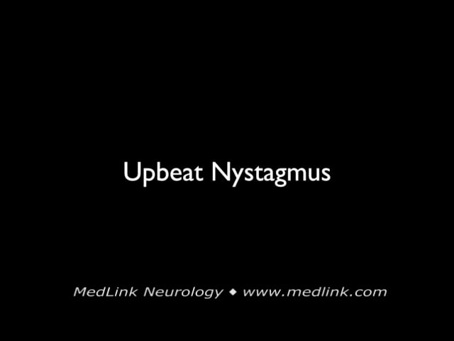 Downbeat nystagmus
