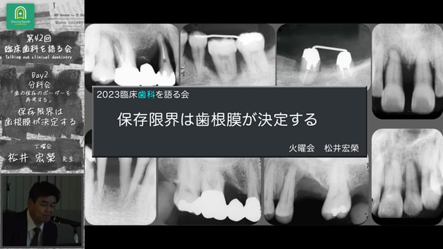 「保存限界は歯根膜が決定する」臨床歯科を語る会 分科会 歯の保存のボーダーを再考する #8　松井宏榮先生