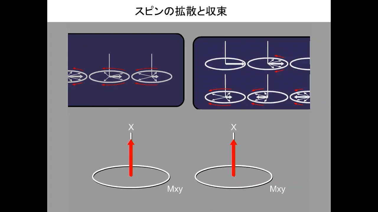 MRIコラム：わかりやすいMRI解説シリーズ その3 ～MRIのパルス