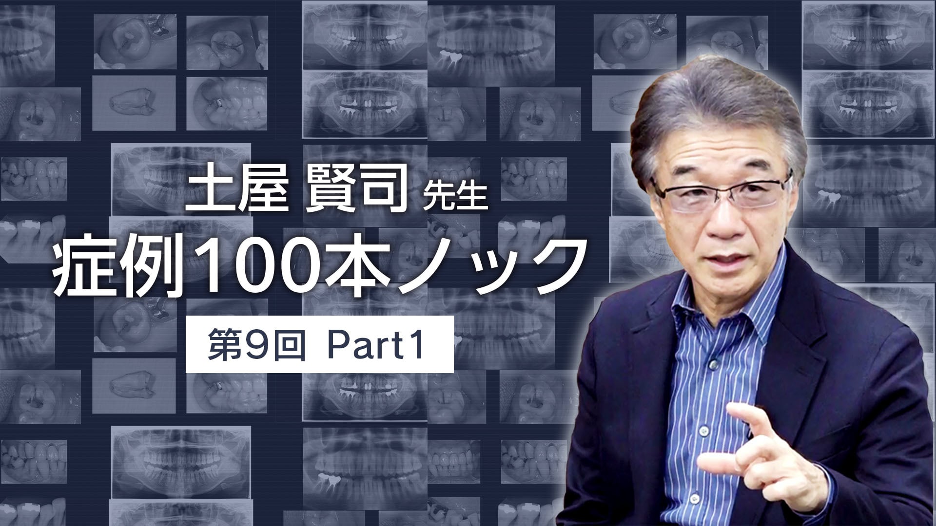 土屋賢司先生 症例100本ノック 第9回 PART1