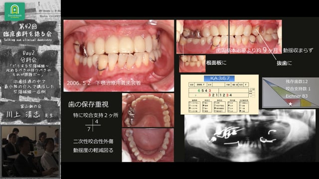 お買い得！】 症例でみる欠損歯列・欠損補綴 : レベル・パターン・スピード 健康/医学 - worldaigroup.com