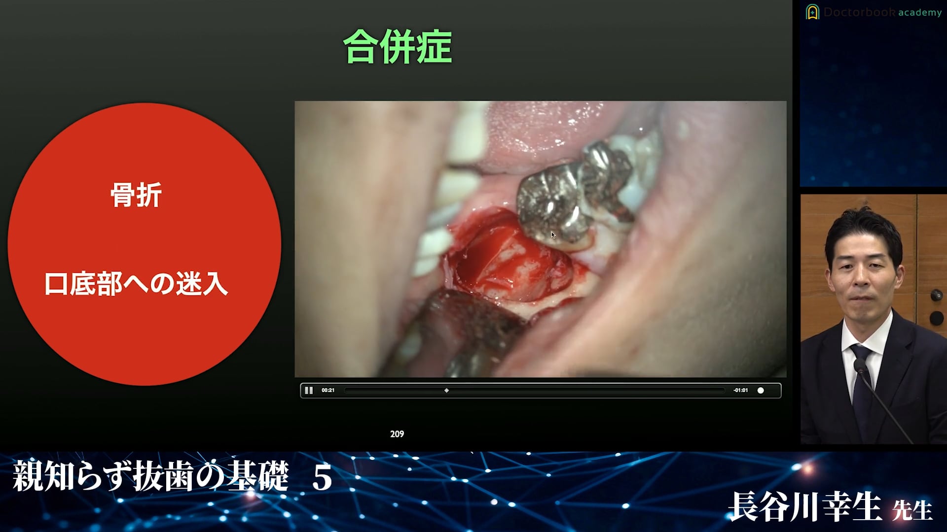 起こりうるトラブルとリカバリー│親知らず抜歯の基礎 5