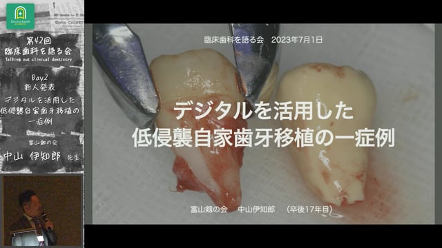 「デジタルを活用した低侵襲自家歯牙移植の一症例」臨床歯科を語る会 新人発表 #1 中山伊知郎先生