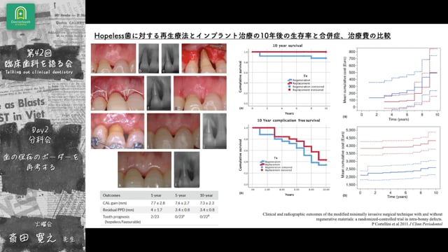 イントロダクション 臨床歯科を語る会 分科会 歯の保存のボーダーを再考する #0 斎田寛之先生
