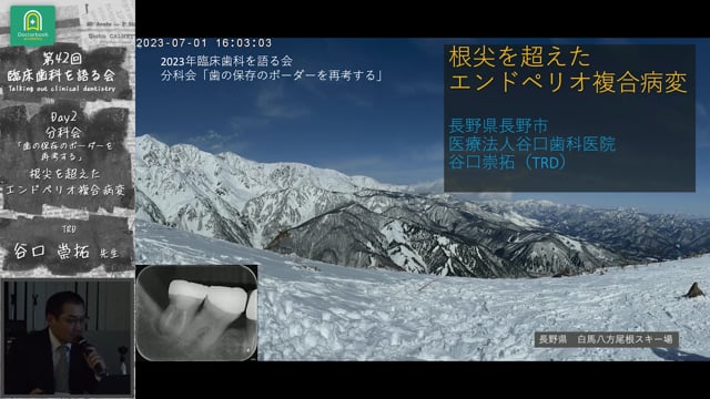 「根尖を超えたエンドペリオ複合病変」臨床歯科を語る会 分科会 歯の保存のボーダーを再考する #6　谷口崇拓先生