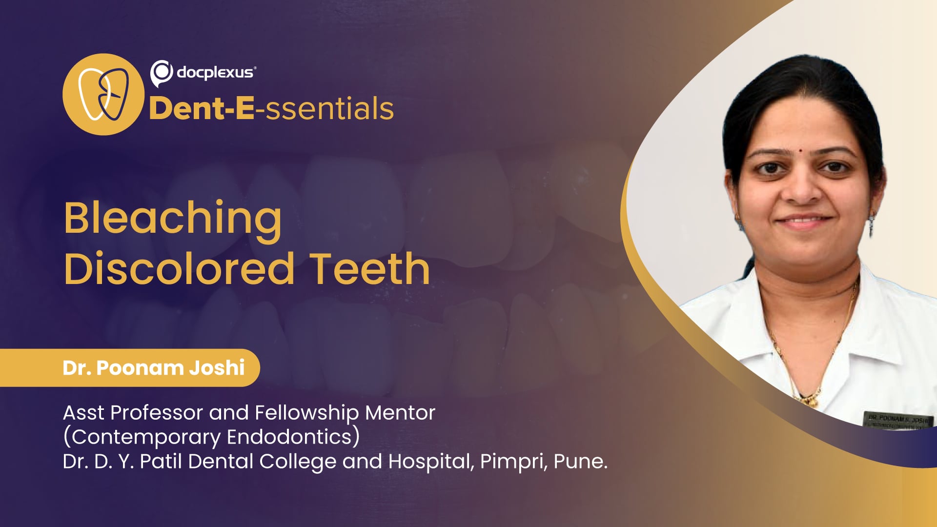 Bleaching Discolored Teeth