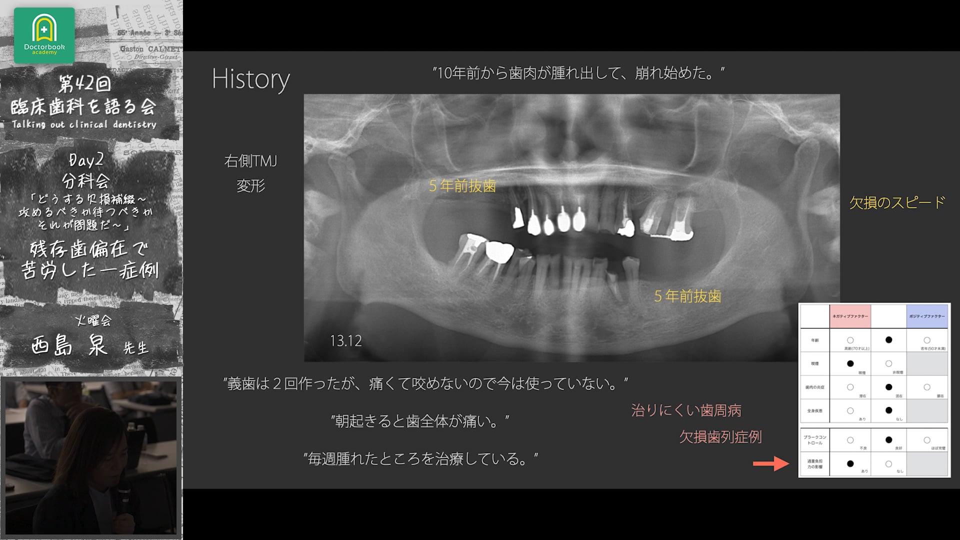 「残存歯偏在で苦労した一症例」臨床歯科を語る会 分科会 どうする欠損補綴～攻めるべきか待つべきか　それが問題だ～ #5　西島泉先生