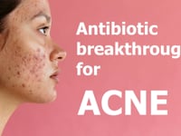 Newswise:Video Embedded tiny-nanocarriers-could-prove-the-magic-bullet-for-acne-sufferers