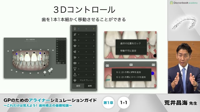 第1章 クリンチェックの特徴│GPのためのアライナーシミュレーション 