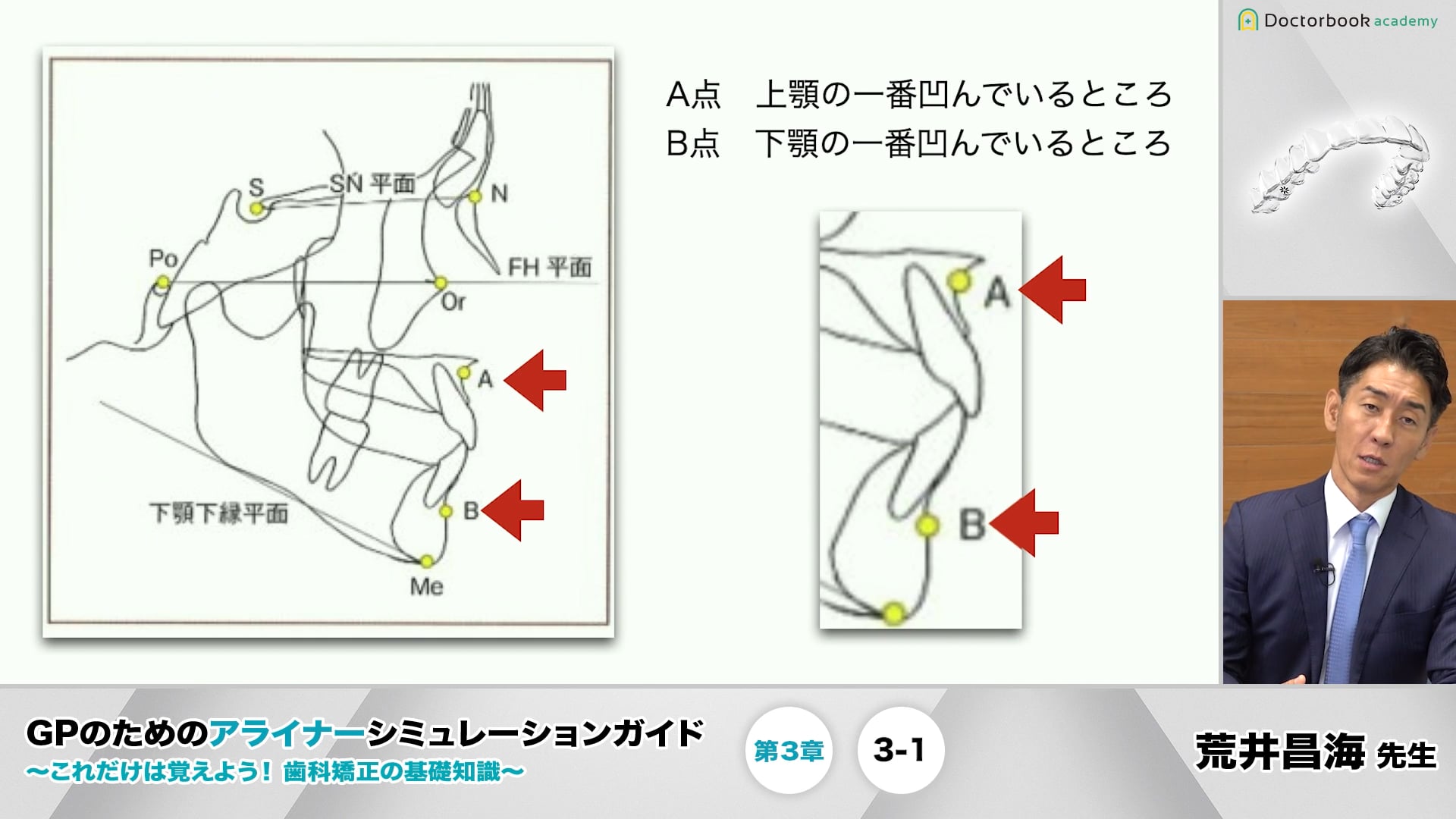 GPのためのアライナーシミュレーションガイド : これだけは覚えよう