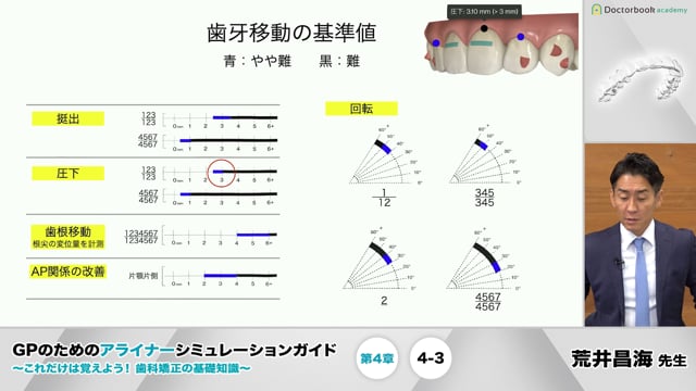 4-3 歯牙移動量の予測実現性