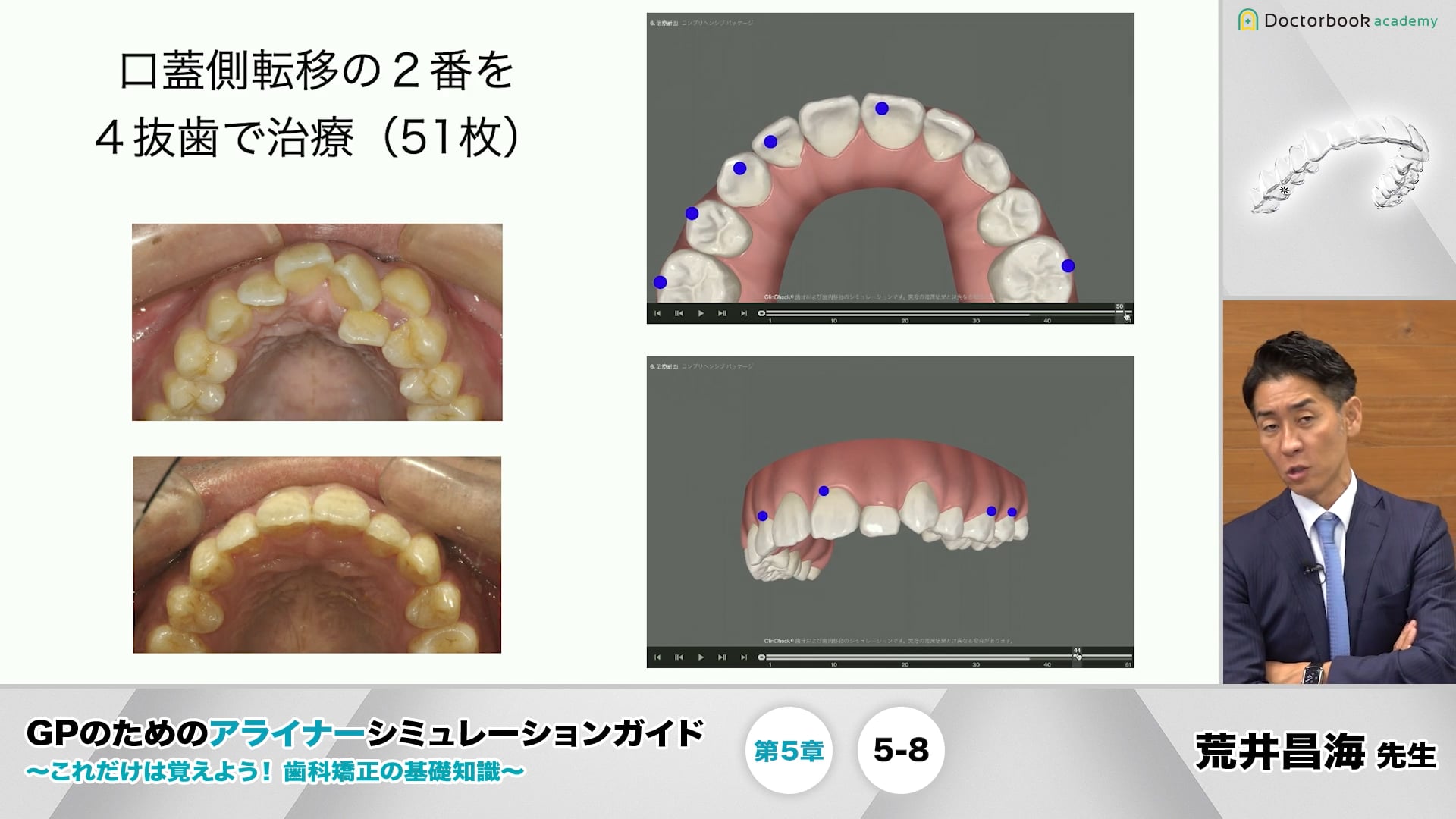 荒井昌海GPのためのアライナーシミュレーションガイド : これだけは