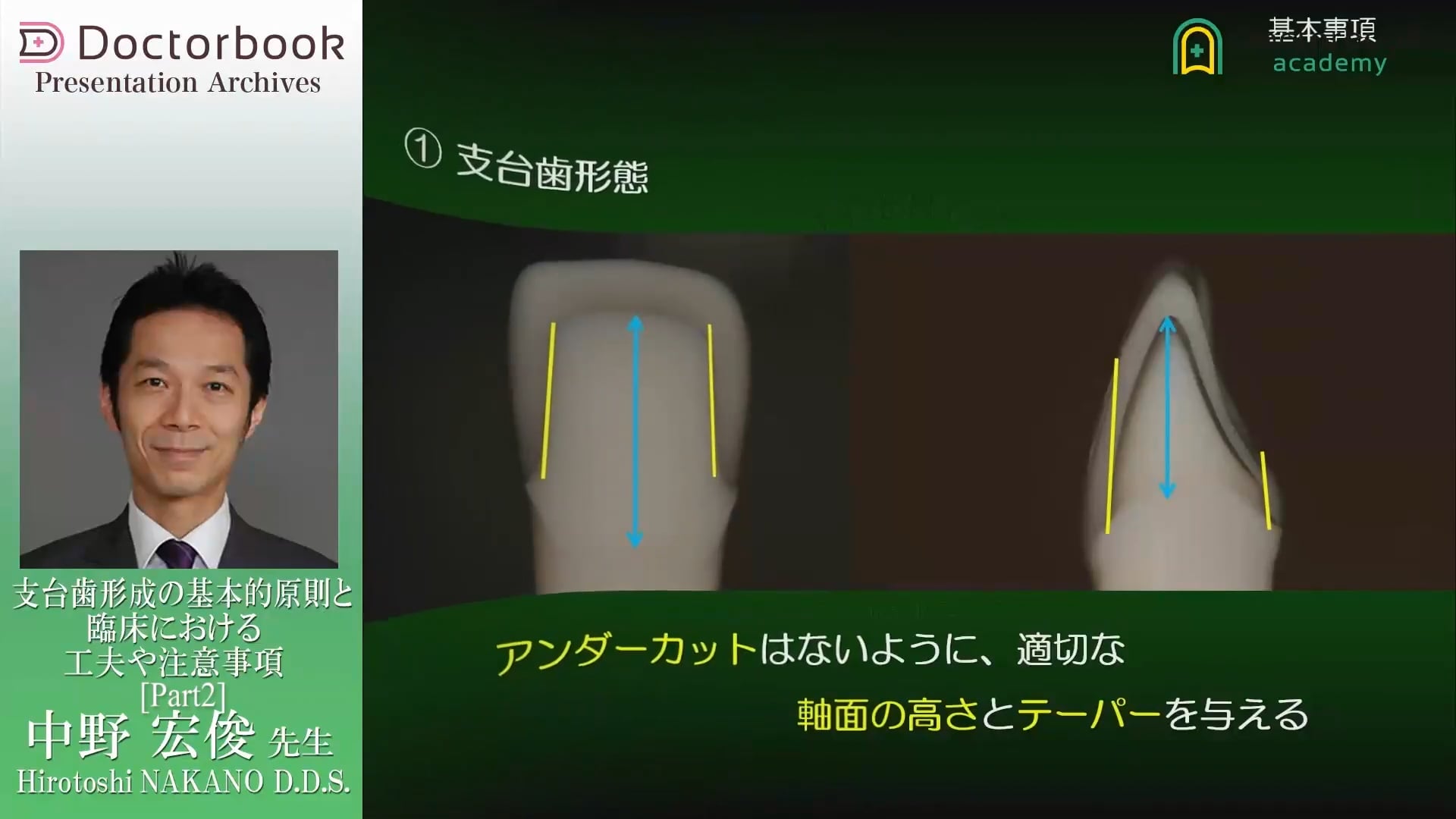 臨床知見録_支台歯形成_支台歯形成の基本事項