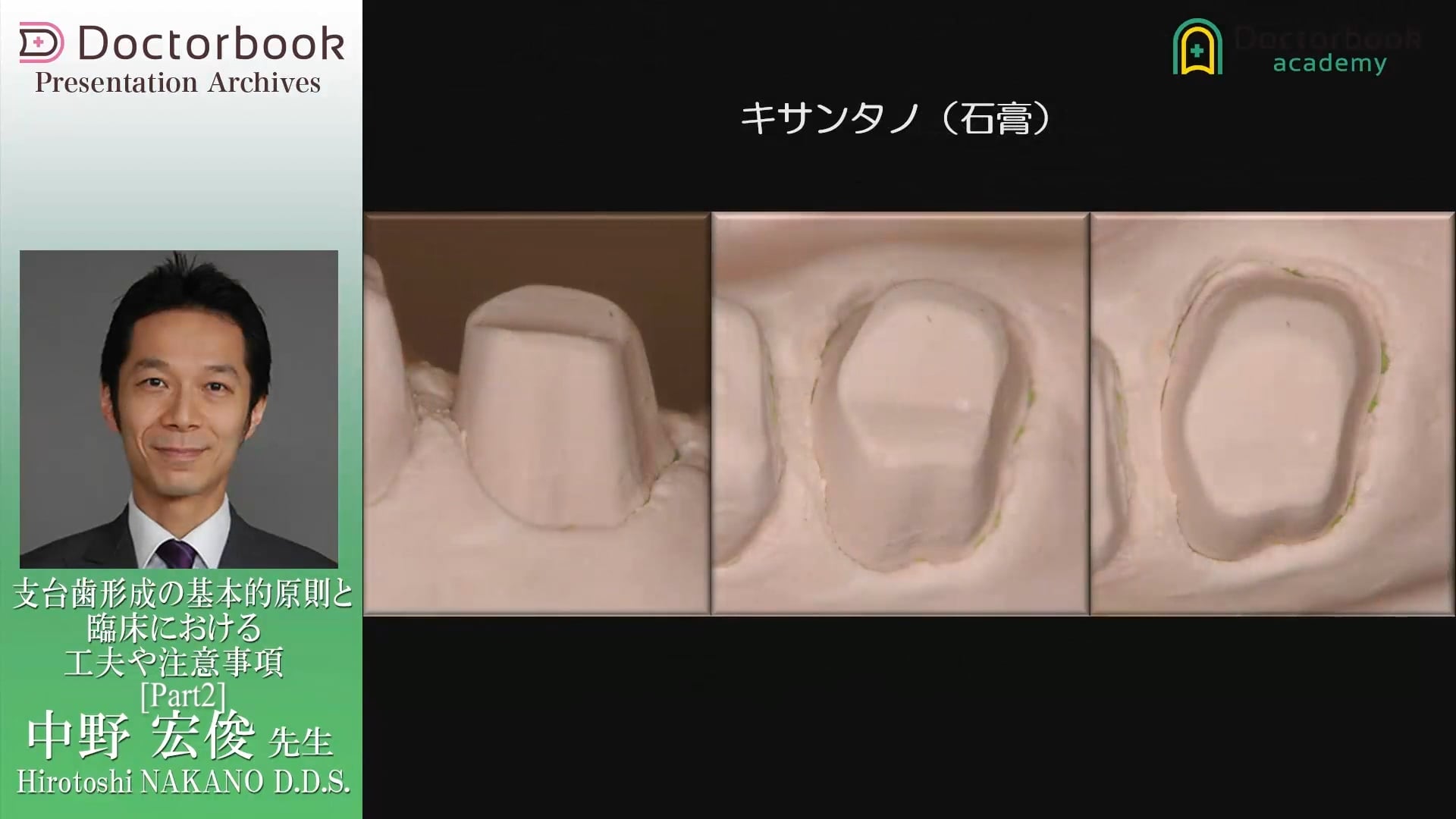 The Basic Planes for Tooth Preparation 支台歯形成の面基準