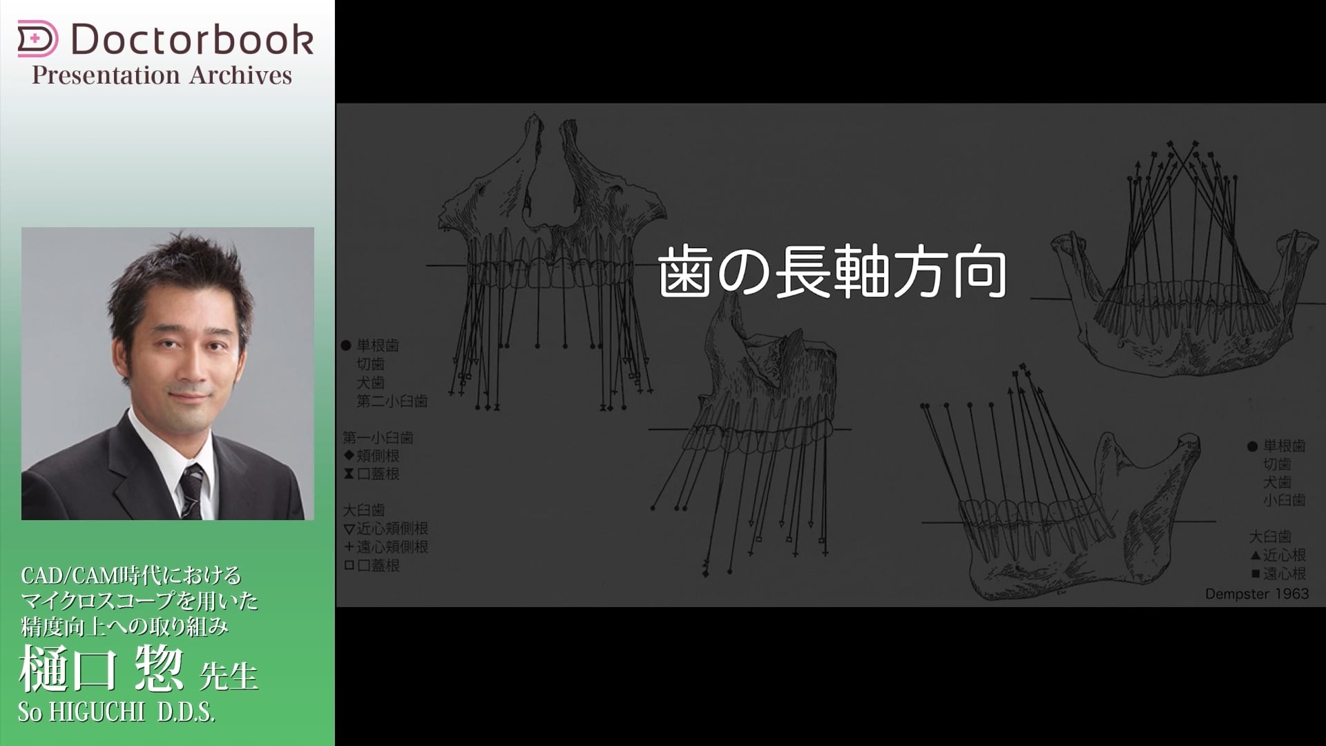 臨床知見録_支台歯形成_支台歯形成のポジショニング