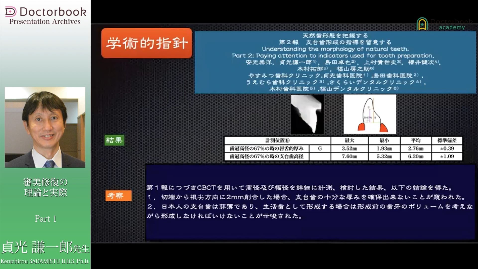 臨床知見録_支台歯形成_支台歯形成の指標