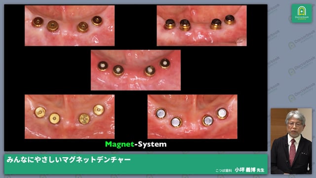 【出版記念講演】IOD みんなにやさしいマグネットデンチャー