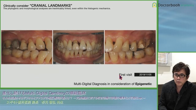 Digitalによって進化する歯科医療システム〜日本に受け継がれる歯科哲学とデジタル〜│杉元 敬弘先生 #2