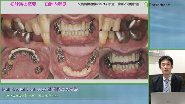 Multi Digital Dentistryの補綴臨床の実際│相宮 秀俊先生 #3