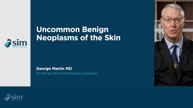 Uncommon Benign Tumors