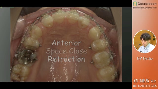GPとしての矯正治療の必要性と可能性 | Doctorbook academy (ドクター 