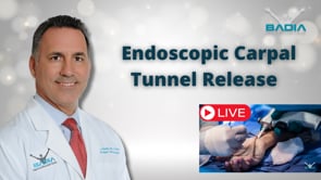 Carpal Tunnel Surgery Treatment of Carpal tunnel by Dr. Alejandro Badia